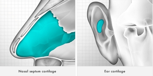 cartilage 